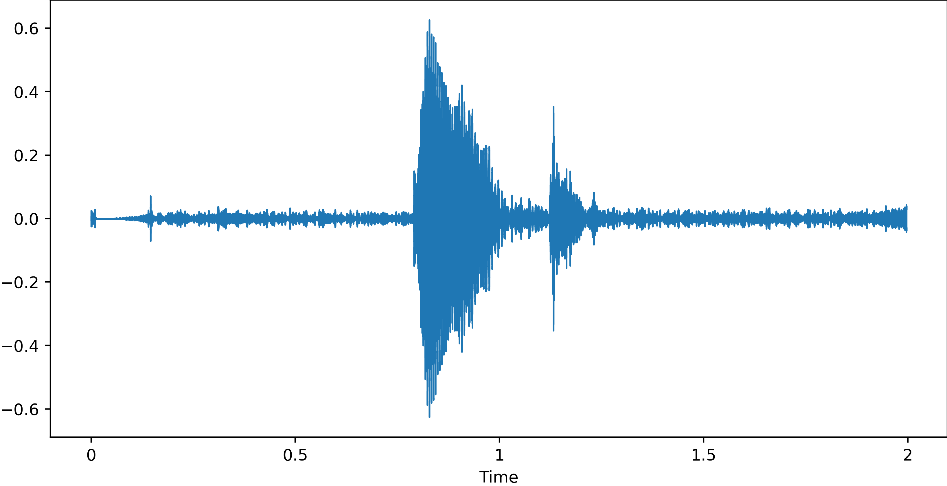 waveform of audio